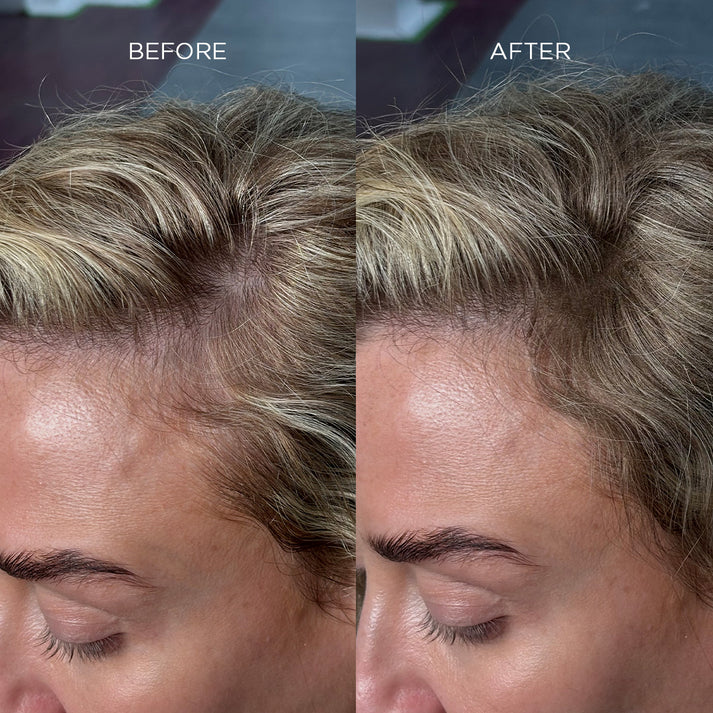 Fibre addensanti per capelli Nanogen bianche