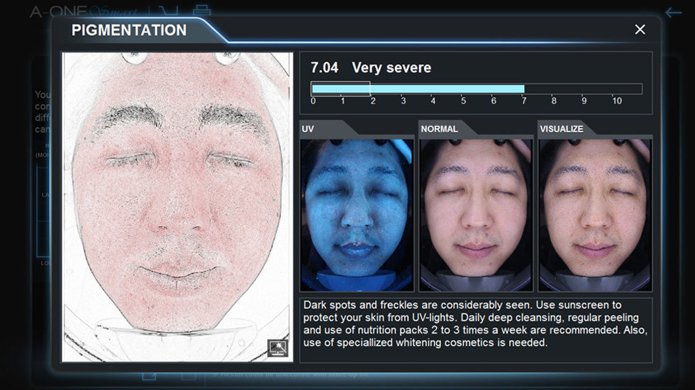 BomTech A-ONE Smart Skin Analyzer - BVShop