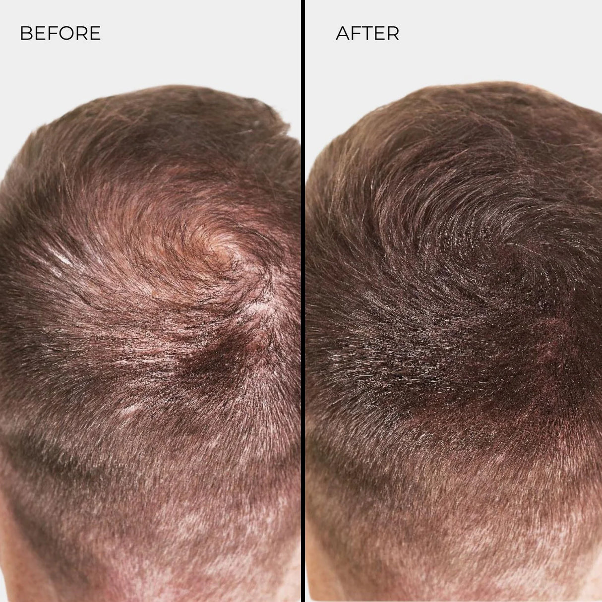 Fibre Addensanti per Capelli Nanogen Marrone Chiaro 15g