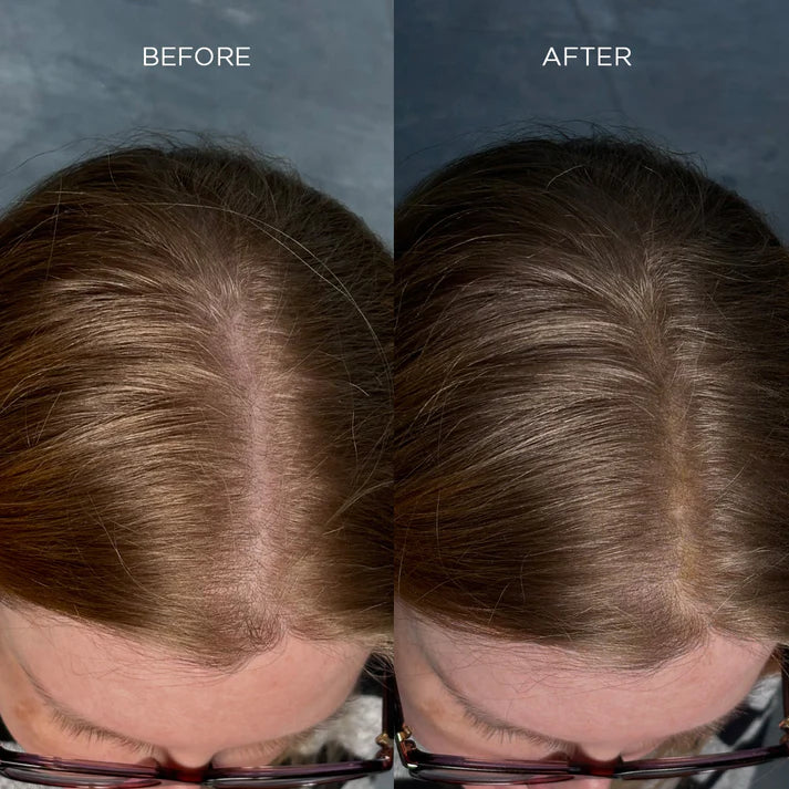 Fibre addensanti per capelli Nanogen bianche