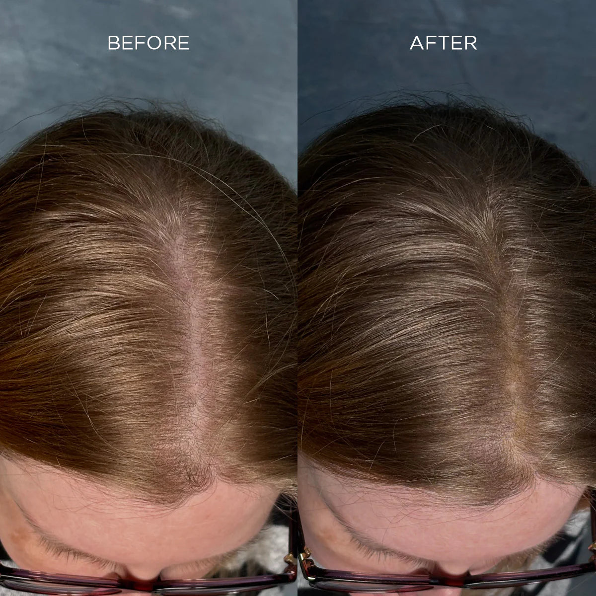 Fibre Addensanti per Capelli Nanogen Cannella