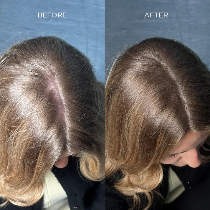 Fibre addensanti per capelli Nanogen bianche