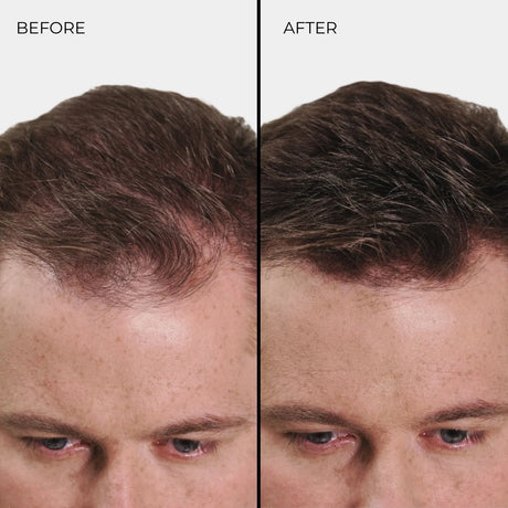 Fibre addensanti per capelli Nanogen biondo chiaro