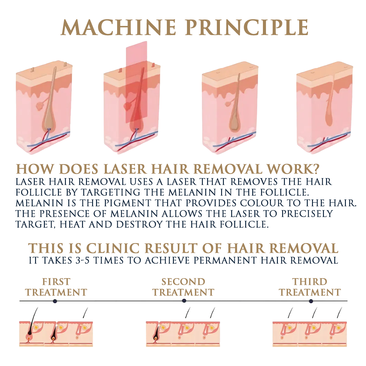 Skin Monarch Qantum Pro Laser a Diodi e Picosecondi