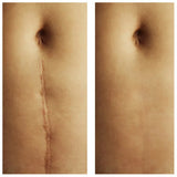 REJUVI - SCARCARE FORMULA 30ml - BVShop